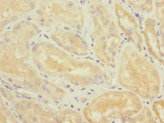 CSB-PA023992ESR2HU IHC