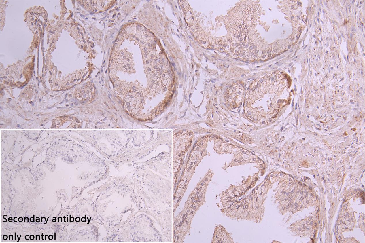 CSB-PA737873LA01HU IHC