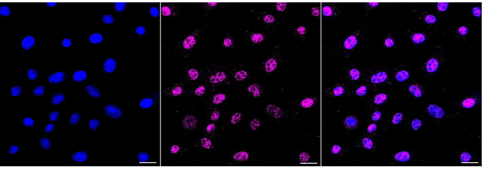 CSB-RA945176A0HU ICC